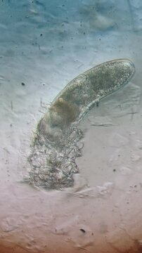 Demodex Mite: Time-Lapse Microscopic Movement