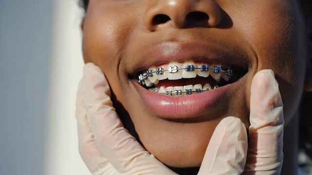 Close-up of a smiling young person, African child with braces on teeth, wearing latex gloves, showing dental care and orthodontic treatment in a bright, clinical environment with focus on oral health.