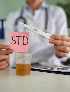 A healthcare professional holds a test strip with a positive result next to a cup containing urine.