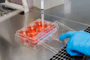 A hand in a blue glove pipettes red liquid into the wells of a laboratory plate on a table.
