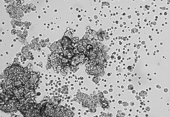 Spheroids of glioblastoma cell culture.