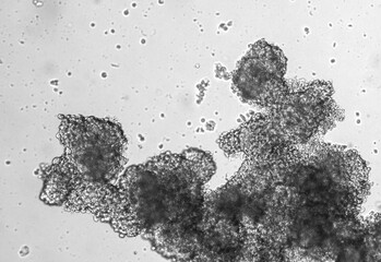 Spheroids of glioblastoma cell culture.