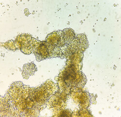 Spheroids of glioblastoma cell culture.