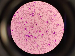 Microscopic Image of Blood Cells – Clinical Lab Test