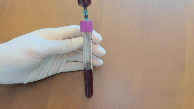 A gloved hand holds a EDTA  tube with a purple cap, being filled with blood via a syringe on a wooden surface.