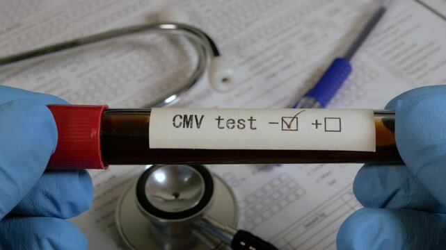Doctor showing positive cmv blood test result