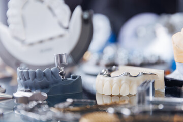 Advanced cnc machine crafting precise dental prostheses in modern laboratory