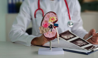 Medical professional examines kidney model while reviewing patient scans