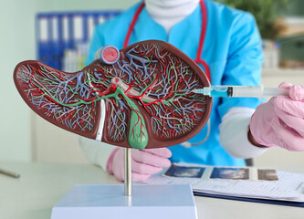 Liver model with injection syringe. Liver injection for alcoholism concept