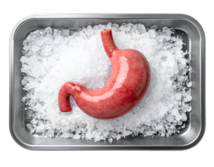 realistic human stomach on crushed ice in stainless steel tray, anatomical preservation or medical concept illustration, on isolated background
