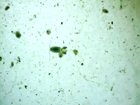 Cyclops in the water on a microscope glass