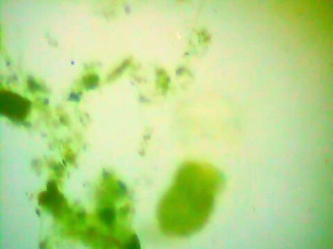 Trnsparent an microscopic rotifer looking for food in the water