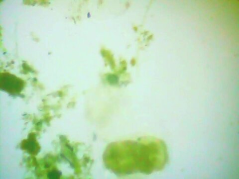 Trnsparent an microscopic rotifer looking for food in the water