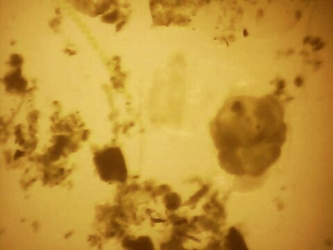Trnsparent an microscopic rotifer looking for food in the water