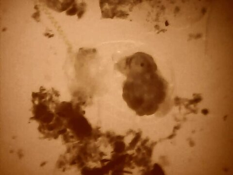 Trnsparent an microscopic rotifer looking for food in the water