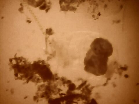Trnsparent an microscopic rotifer looking for food in the water