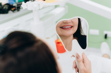 Close-up of a woman's mouth with white teeth during a dental procedure in a clinic.