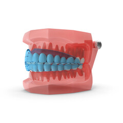 Typodont with Transparent Removable Retainer isolated on transparent background