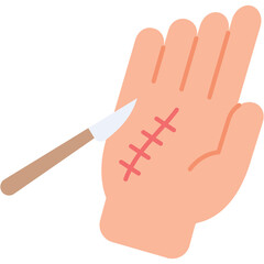 Hand Surgery Illustration