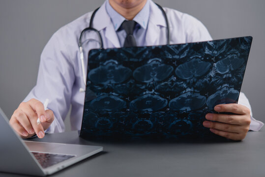 doctor analyzing brain scan or MRI film working on a laptop, representing radiology, diagnosis, and modern medical technology in neurological assessment.