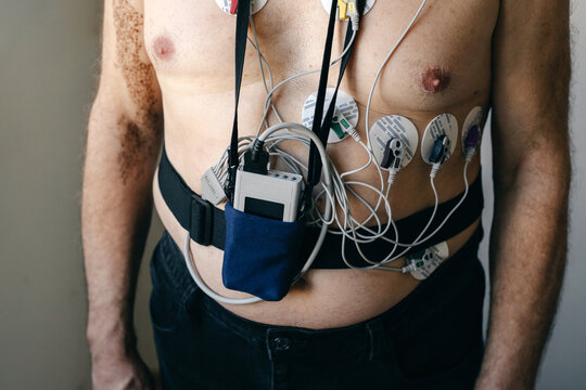 Elderly man with a Holter monitor against a light wall.