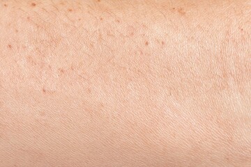 Fototapeta premium Delving Into the Intricate Details of Skin Texture Reveals a Fascinating Array of Small Moles and Subtle Variations in Color and Tone