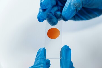 Close Up Of Blood Sample Held by Blue Glove Clinical Staff