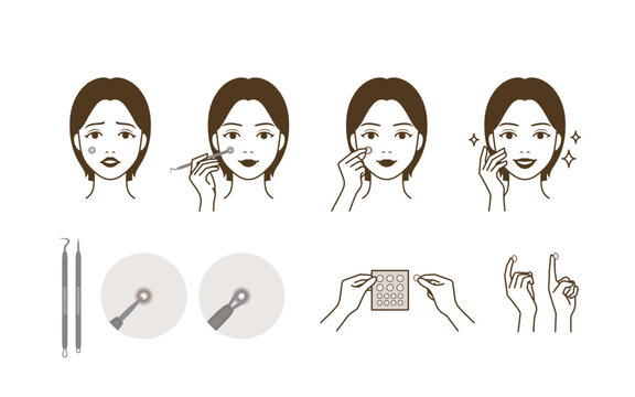 A cute woman character who extracts and removes whitehead, zit, acne with pimple potter tool and trouble patch