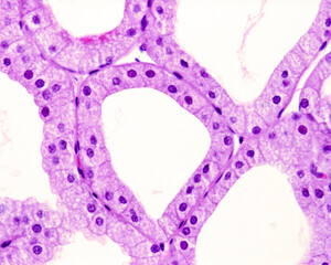 Alveolar gland