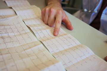 Doctor analyzing electrocardiogram printout in hospital setting