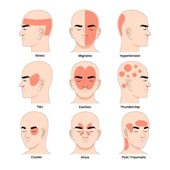 Obraz premium Different Types of Headache Syndrome Disorder, Educational Medical Poster Design Healthcare Scheme, Labeled Cluster, Exertion, Hypertension, Migraine, Post, Traumatic, Sinus, Stress, Thunderclap, TMJ.