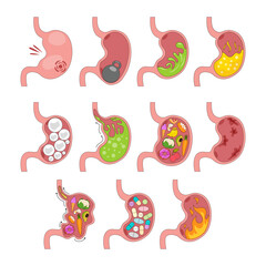Different Types of Stomach Disease Set Collection, Educational Medical Poster Design Healthcare Scheme, Labeled Stomach, Acid, Reflux, GERD, Bloating, Burning, Full, Heaviness, Ulcer, Vomiting, Pills.