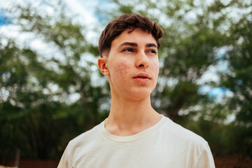 Teenage boy with acne and braces gazing thoughtfully into the distance while standing outdoors