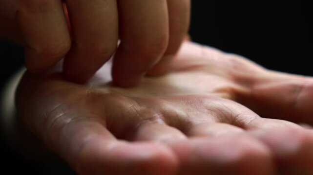 Close-up of a man scratching his palm.
A man's palm and severe itching.
Close-up of a man's hand.
Itching and severe itching of the hand.
Allergy on the hand