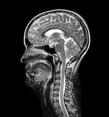 Brain anatomy, 3D illustration and composite MRI
