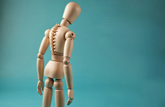 Wooden mannequin back showing scoliosis spine curvature. Back pain concept, spinal problem, unhealthy posture. Model with unhealthy curved spine, healthcare issue, medical background. - Powered by Adobe