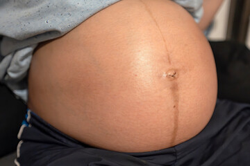Close-Up of Pregnant Belly Highlighting the Linea Nigra and Belly Button