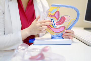 The gynecologist shows the patient an anatomical model of the vagina and talks about the control ring as a means of contraception