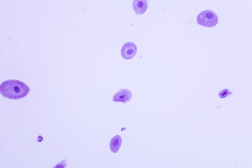 Human normal squamous epithelial cells view in microscopy.Atrophic smear criteria for pap smear...