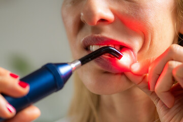 Red light therapy applied to the mouth promotes healing of oral tissues and reduces inflammation....
