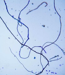 Microscopic view of blue fungal hyphae on a white background, showcasing intricate structures and...