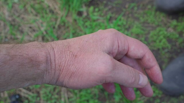 Bee sting therapy: The beekeeper places a bee with a visible stinger on his hand.