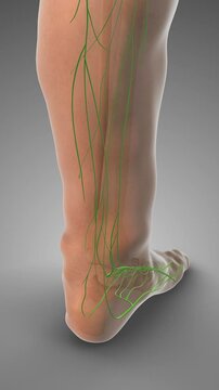 Accumulated Fluid Triggering Pitting Edema