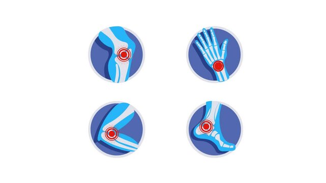 Joint Pain Animation on White and Green Screen Background
