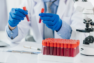 Scientist analyzing blood sample using microscope in laboratory. Scientist in gloves examines a blood sample under a microscope in a lab, discovering medical mysteries.