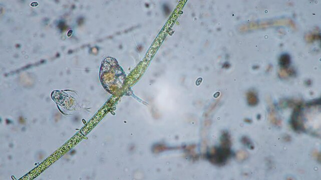 The amazing world of microbiology. Different bacteria, microbes and single-celled microorganisms are visible through a microscope. High-quality video.	
