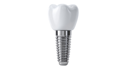 Dental implant: a detailed view of a single, pristine dental implant, showcasing the innovative fusion of bio-compatible materials for a confident, natural smile.