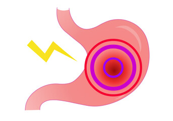 Stomach  problems. Acid reflux, pancreas pain, gastro problems, gastric, disease, cancer digestive gastrointestinal. digestive system. Vector illustration