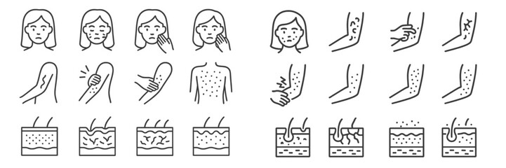 Skin conditions and their symptoms illustrated in a clear and informative manner for educational purposes