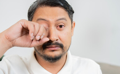 Close-up Asian man suffering from irritated eye with copy space, concept of optical health care,...
